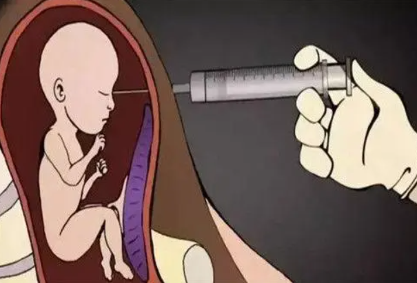 打胎真的有怨灵吗-音狐运势网